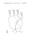 METHOD AND APPARATUS FOR CREATING A HIGH RESOLUTION MAP OF THE ELECTRICAL     AND MECHANICAL PROPERTIES OF THE HEART diagram and image