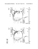 METHOD AND APPARATUS FOR CREATING A HIGH RESOLUTION MAP OF THE ELECTRICAL     AND MECHANICAL PROPERTIES OF THE HEART diagram and image