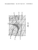 METHOD AND APPARATUS FOR CREATING A HIGH RESOLUTION MAP OF THE ELECTRICAL     AND MECHANICAL PROPERTIES OF THE HEART diagram and image