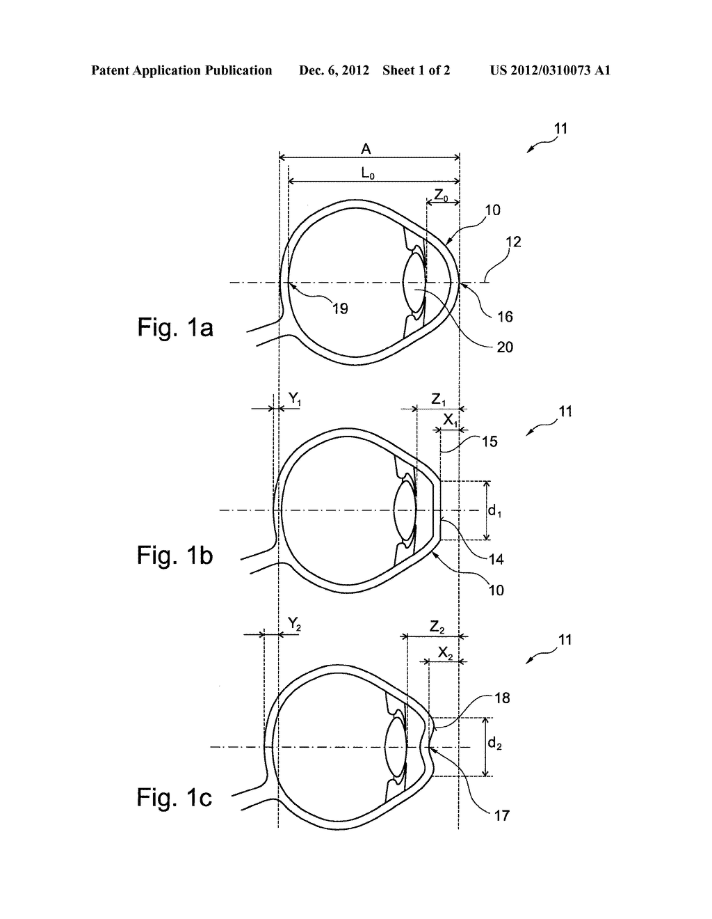 Ophthalmological Analysis Method And Analysis System - diagram, schematic, and image 02