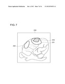 MEDICAL IMAGE PROCESSING APPARATUS, A MEDICAL IMAGING APPARATUS, AND A     MEDICAL IMAGE PROCESSING PROGRAM diagram and image