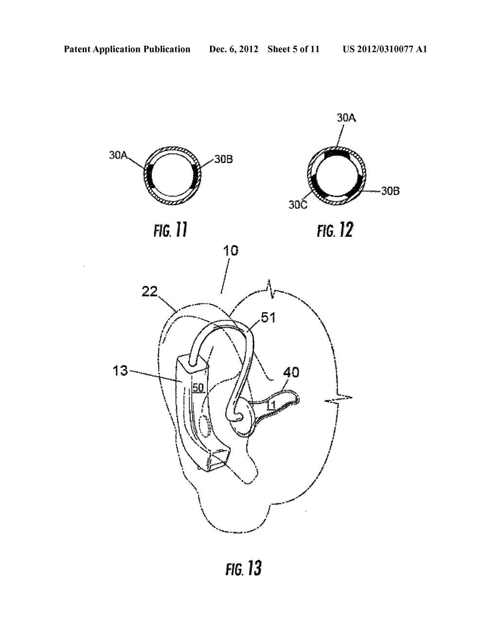 Neurophysiological Activation by Vestibular or Cranial Nerve Stimulation - diagram, schematic, and image 06