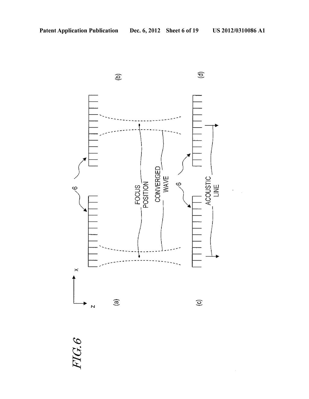 ULTRASONIC DIAGNOSTIC DEVICE, AND METHOD FOR MEASURING INTIMA-MEDIA     THICKNESS - diagram, schematic, and image 07