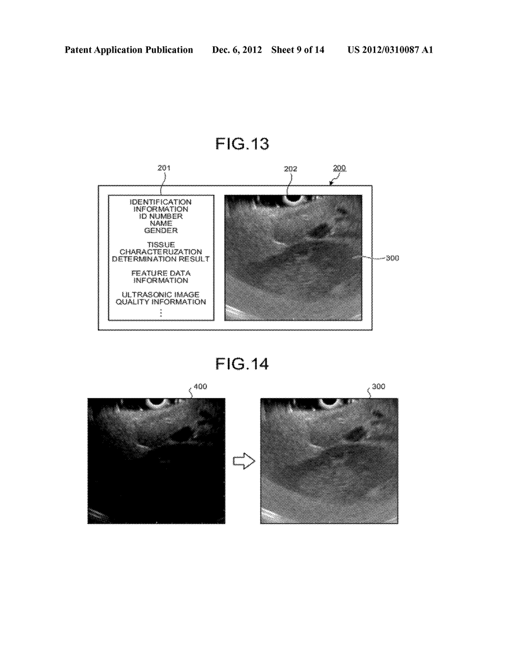 ULTRASONIC DIAGNOSIS APPARATUS, OPERATION METHOD OF THE SAME, AND COMPUTER     READABLE RECORDING MEDIUM - diagram, schematic, and image 10