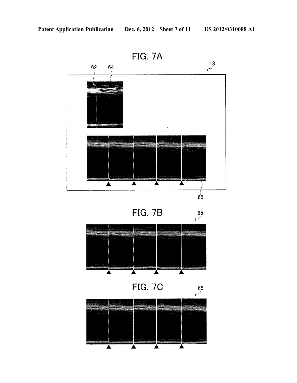 ULTRASOUND DIAGNOSTIC APPARATUS - diagram, schematic, and image 08