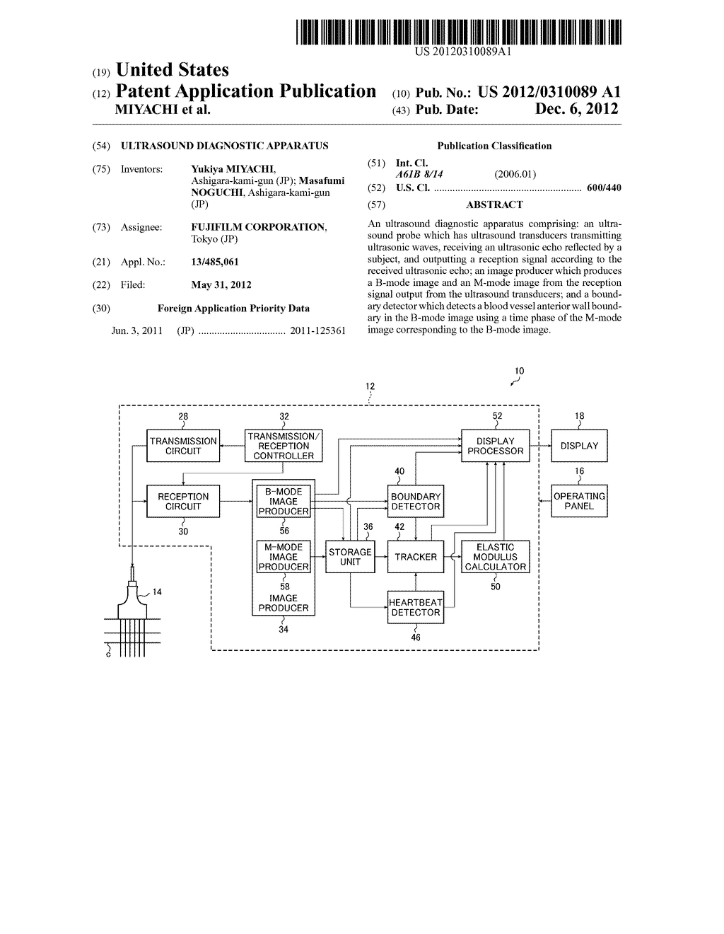 ULTRASOUND DIAGNOSTIC APPARATUS - diagram, schematic, and image 01