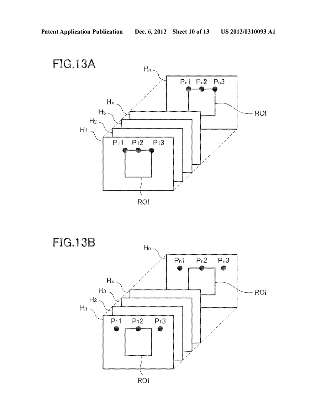 ULTRASOUND IMAGE PRODUCING METHOD AND ULTRASOUND IMAGE DIAGNOSTIC     APPARATUS - diagram, schematic, and image 11