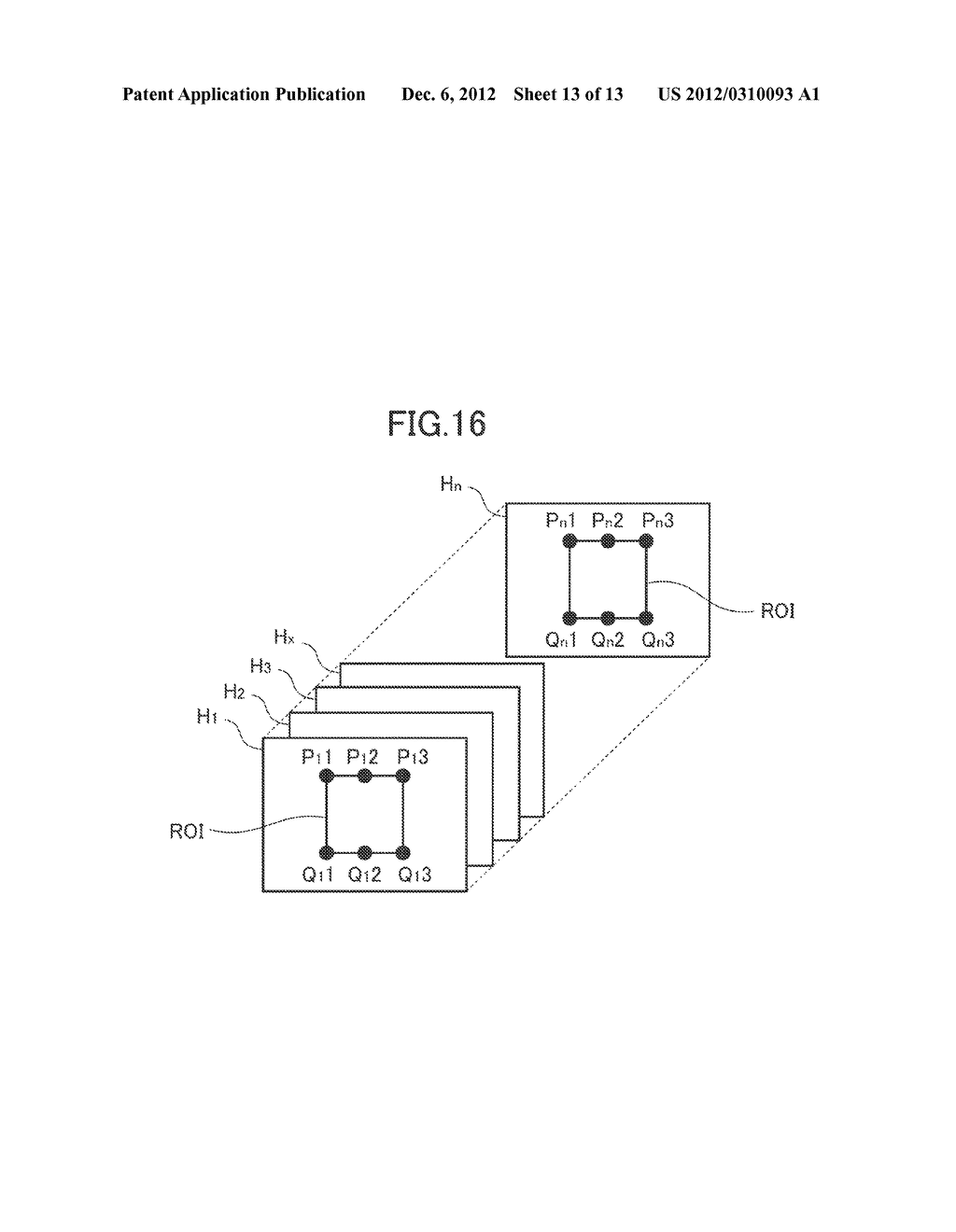 ULTRASOUND IMAGE PRODUCING METHOD AND ULTRASOUND IMAGE DIAGNOSTIC     APPARATUS - diagram, schematic, and image 14