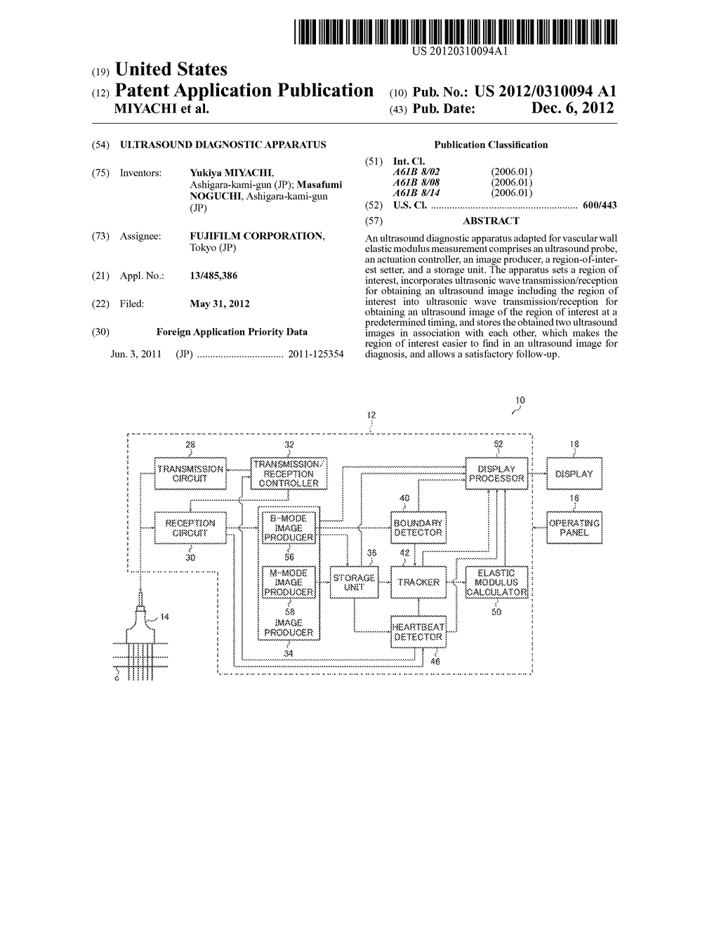 ULTRASOUND DIAGNOSTIC APPARATUS - diagram, schematic, and image 01