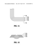 SURGICAL IMAGING DEVICE diagram and image