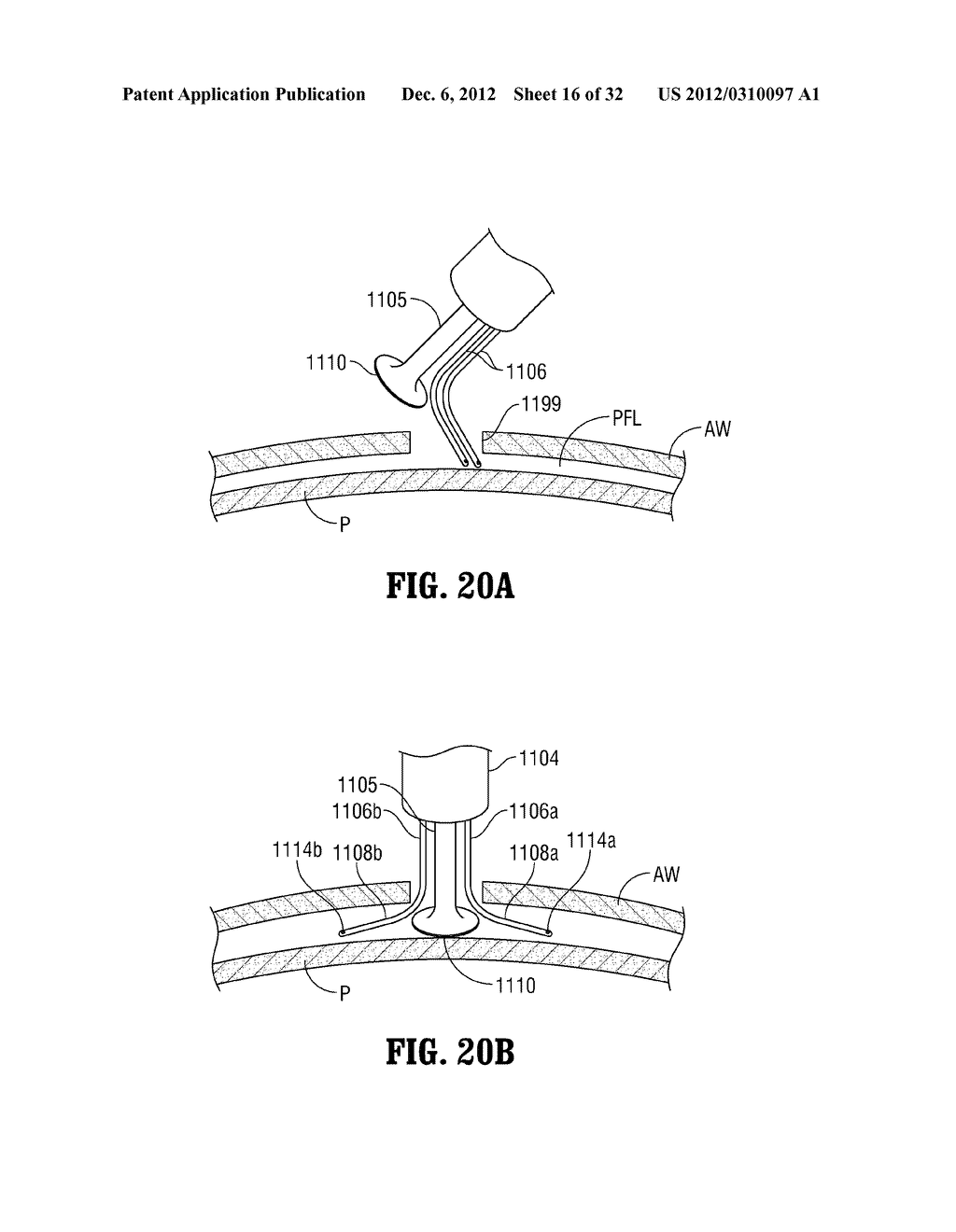 SURGICAL IMAGING DEVICE - diagram, schematic, and image 17