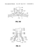 SURGICAL IMAGING DEVICE diagram and image