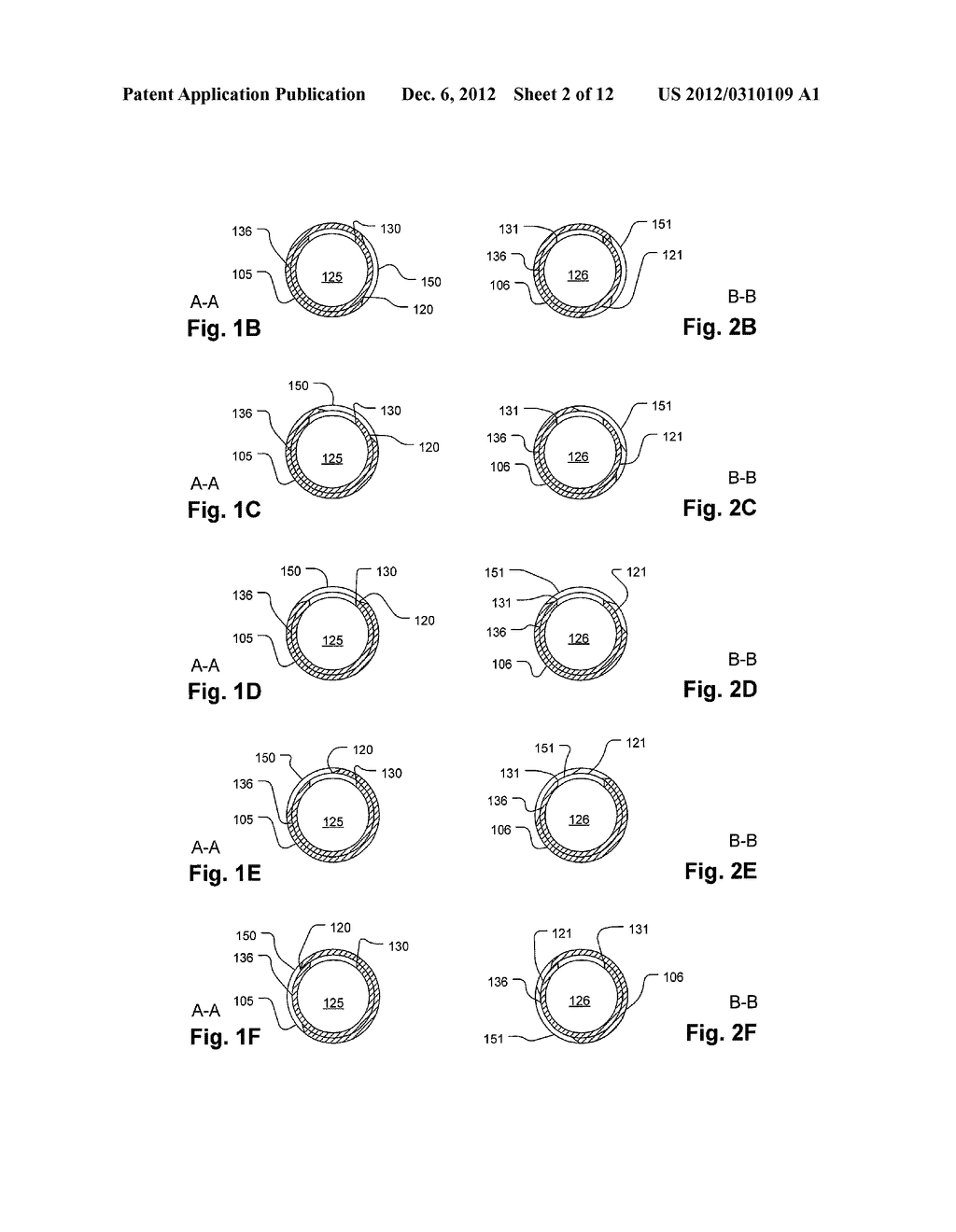 Self-contained Handheld Biopsy Needle - diagram, schematic, and image 03