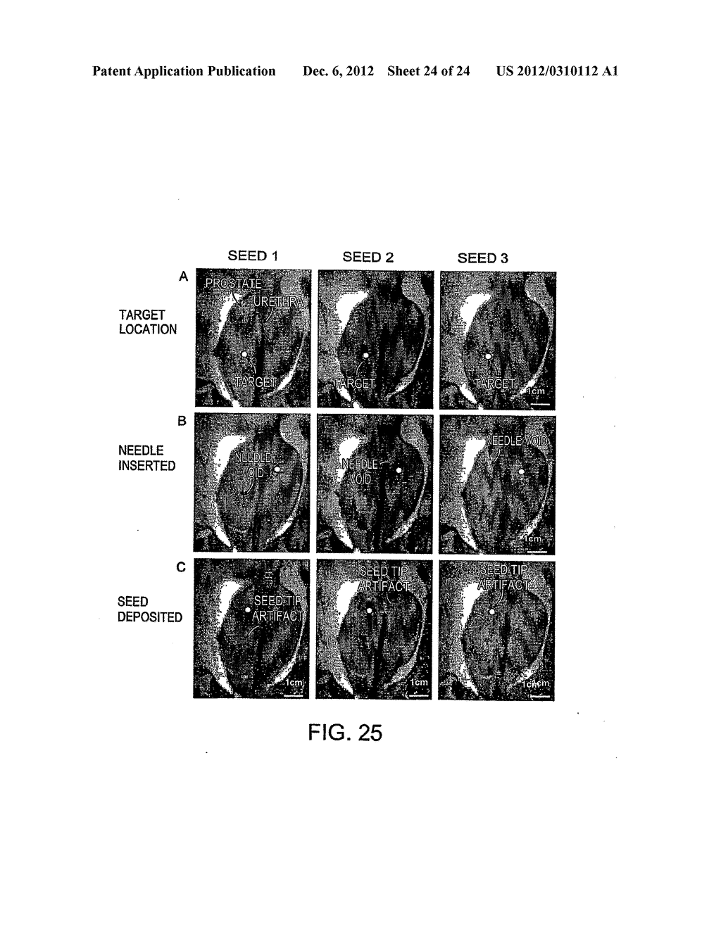 APPARATUS FOR INSERTION OF A MEDICAL DEVICE DURING A MEDICAL IMAGING     PROCESS - diagram, schematic, and image 25