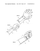 Modular Upper Extremity Support System diagram and image