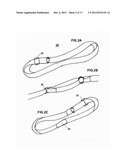 Modular Upper Extremity Support System diagram and image