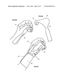 Modular Upper Extremity Support System diagram and image