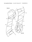 Modular Upper Extremity Support System diagram and image