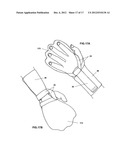 Modular Upper Extremity Support System diagram and image