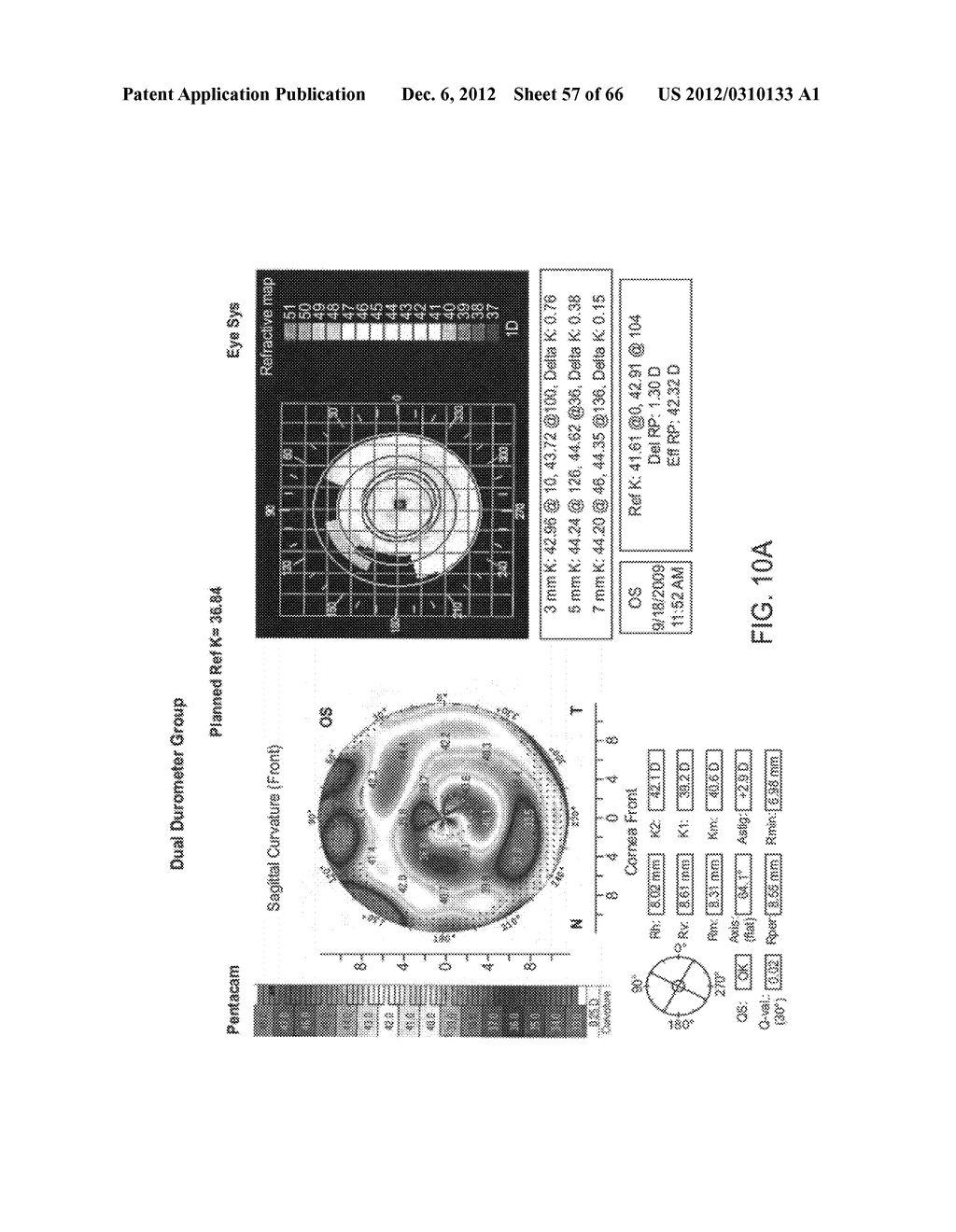 Conformable Therapeutic Shield for Vision and Pain - diagram, schematic, and image 58