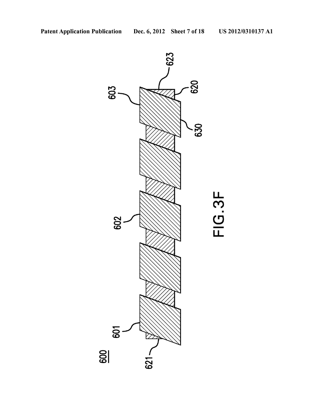 EYE SHUNT WITH POROUS STRUCTURE - diagram, schematic, and image 08