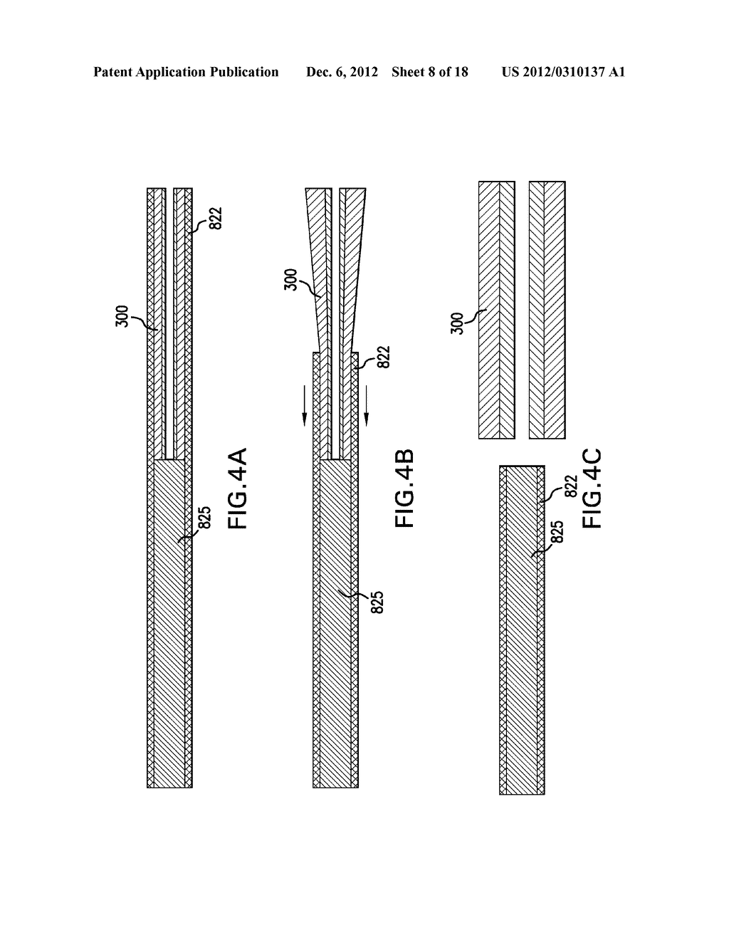 EYE SHUNT WITH POROUS STRUCTURE - diagram, schematic, and image 09