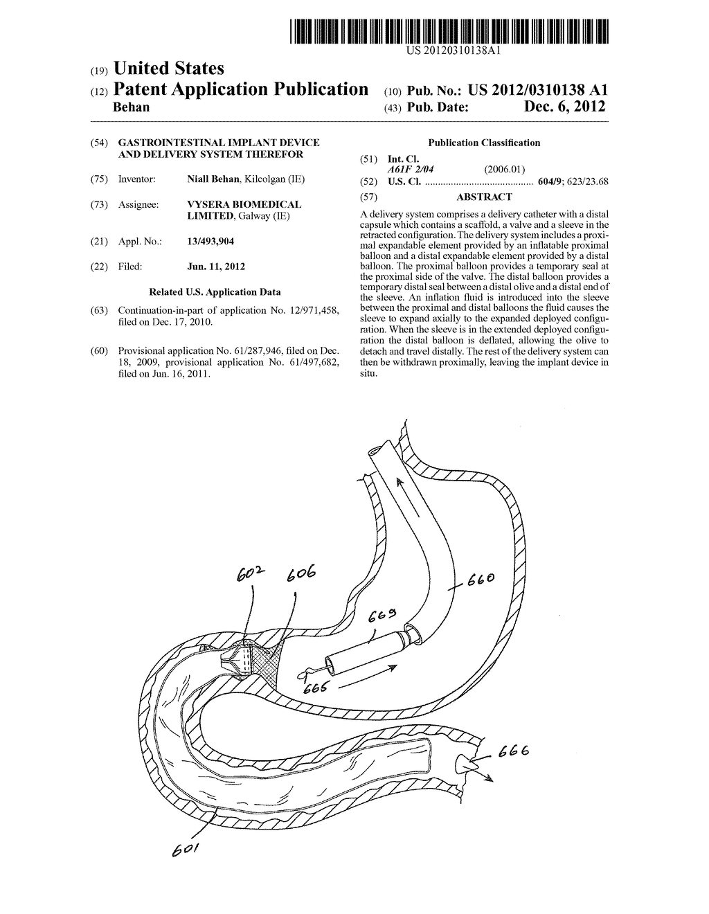 GASTROINTESTINAL IMPLANT DEVICE AND DELIVERY SYSTEM THEREFOR - diagram, schematic, and image 01