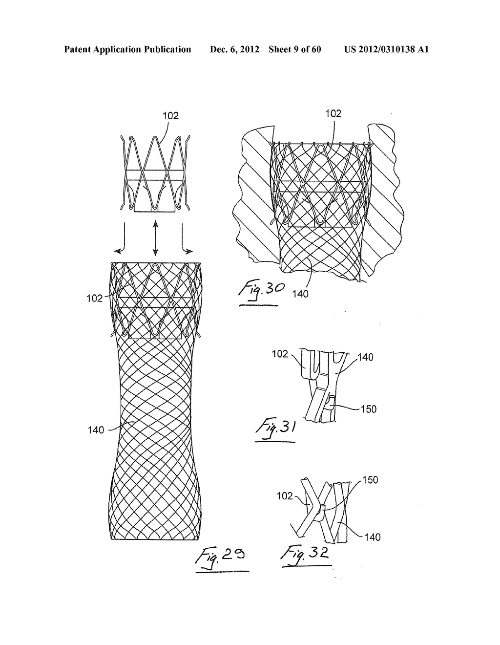 GASTROINTESTINAL IMPLANT DEVICE AND DELIVERY SYSTEM THEREFOR - diagram, schematic, and image 10