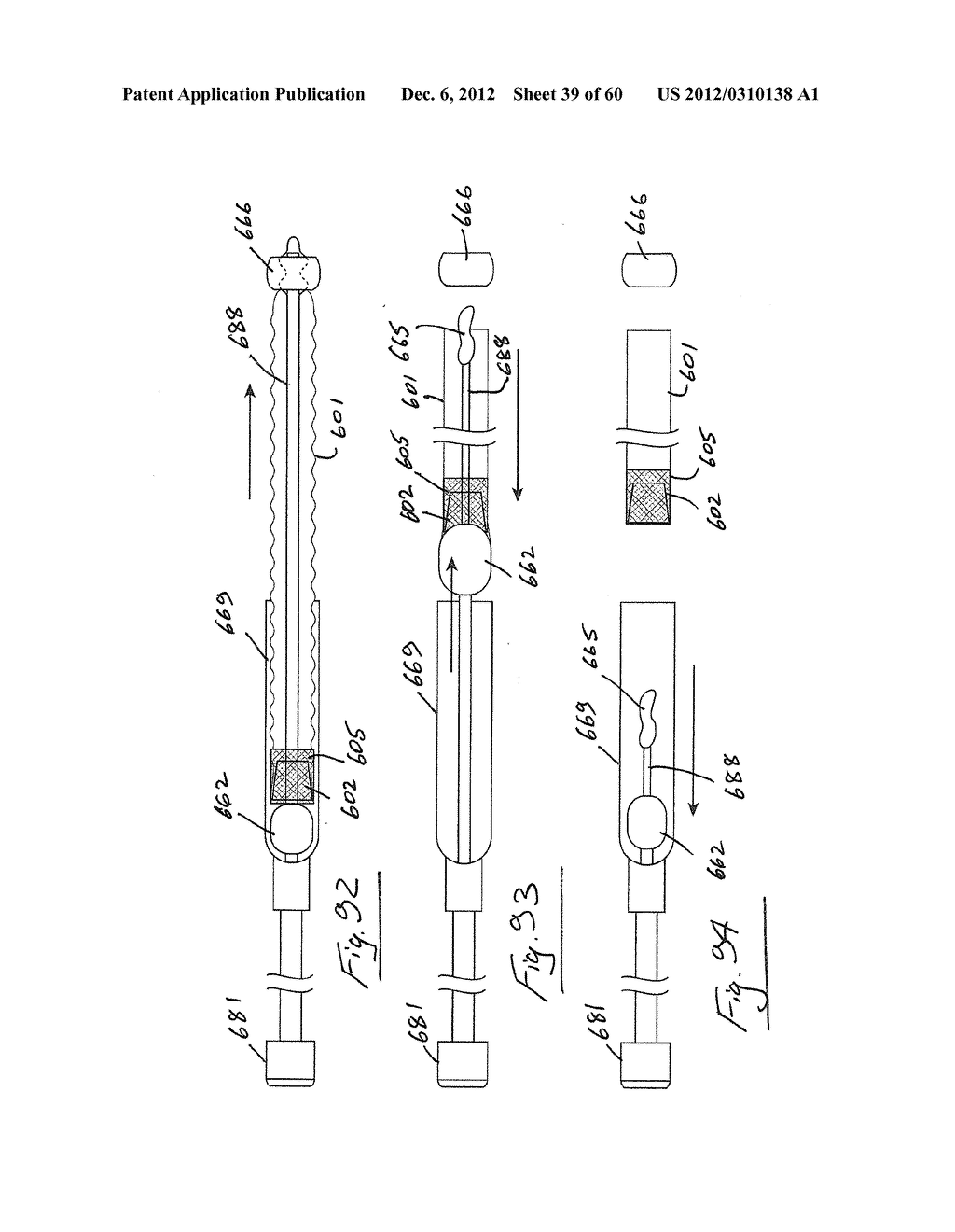 GASTROINTESTINAL IMPLANT DEVICE AND DELIVERY SYSTEM THEREFOR - diagram, schematic, and image 40