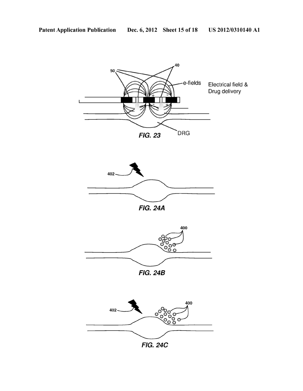 DIRECTED DELIVERY OF AGENTS TO NEURAL ANATOMY - diagram, schematic, and image 16