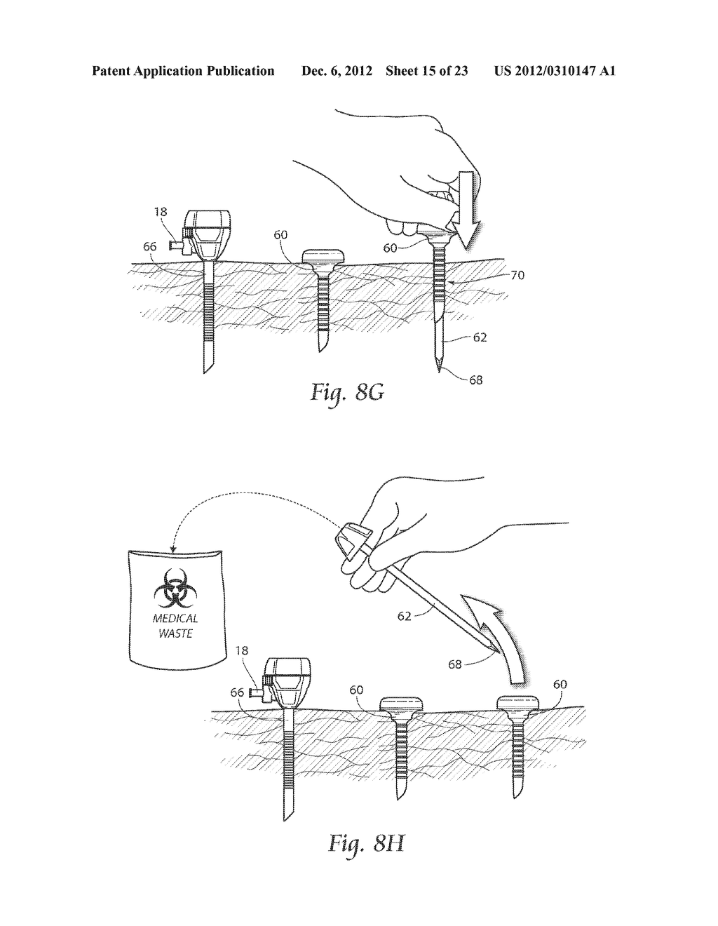 DEVICES, SYSTEMS, AND METHODS FOR PERFORMING ENDOSCOPIC SURGICAL     PROCEDURES - diagram, schematic, and image 16