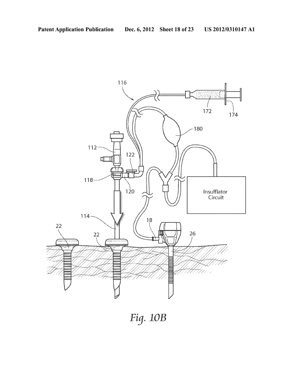 DEVICES, SYSTEMS, AND METHODS FOR PERFORMING ENDOSCOPIC SURGICAL     PROCEDURES - diagram, schematic, and image 19