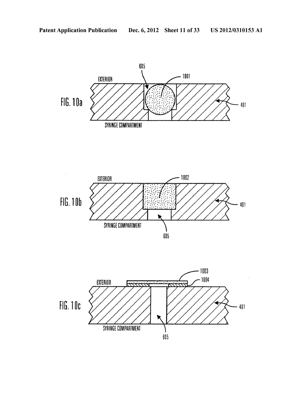 METHOD AND APPARATUS FOR DETECTING OCCLUSIONS IN AN AMBULATORY INFUSION     PUMP - diagram, schematic, and image 12