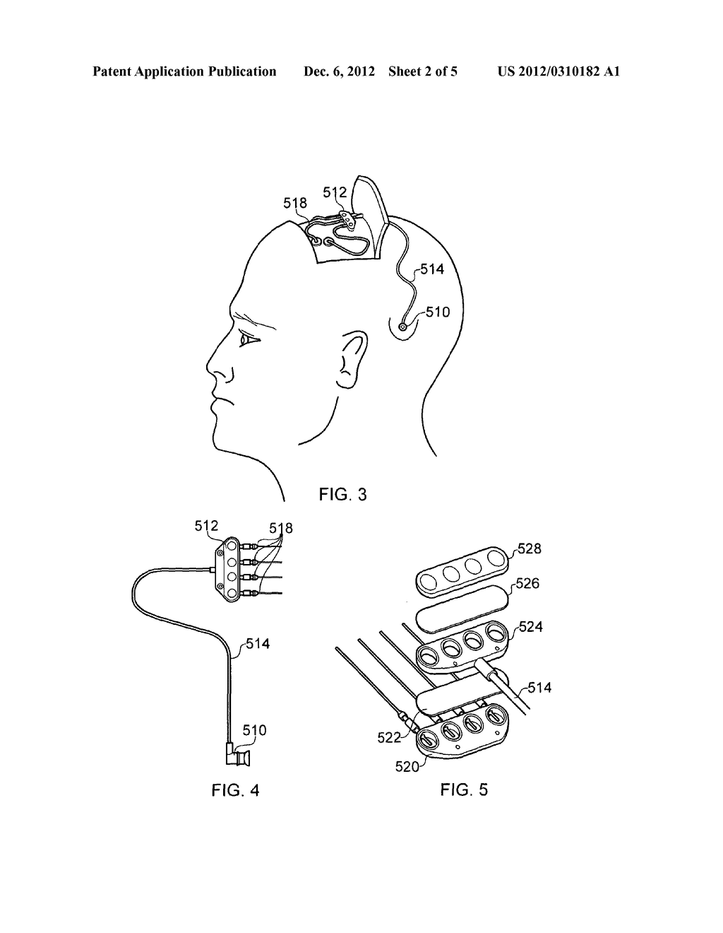 IMPLANTABLE FLUID ROUTER - diagram, schematic, and image 03