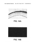 ELUTING MEDICAL DEVICES diagram and image