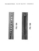 ELUTING MEDICAL DEVICES diagram and image