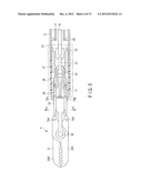 TREATMENT APPARATUS diagram and image