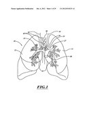 SYSTEMS, APPARATUSES, AND METHODS FOR TREATING TISSUE AND CONTROLLING     STENOSIS diagram and image