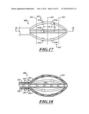 SYSTEMS, APPARATUSES, AND METHODS FOR TREATING TISSUE AND CONTROLLING     STENOSIS diagram and image