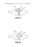 SYSTEMS, APPARATUSES, AND METHODS FOR TREATING TISSUE AND CONTROLLING     STENOSIS diagram and image