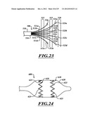 SYSTEMS, APPARATUSES, AND METHODS FOR TREATING TISSUE AND CONTROLLING     STENOSIS diagram and image