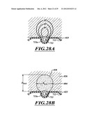 SYSTEMS, APPARATUSES, AND METHODS FOR TREATING TISSUE AND CONTROLLING     STENOSIS diagram and image