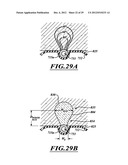 SYSTEMS, APPARATUSES, AND METHODS FOR TREATING TISSUE AND CONTROLLING     STENOSIS diagram and image