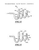 SYSTEMS, APPARATUSES, AND METHODS FOR TREATING TISSUE AND CONTROLLING     STENOSIS diagram and image