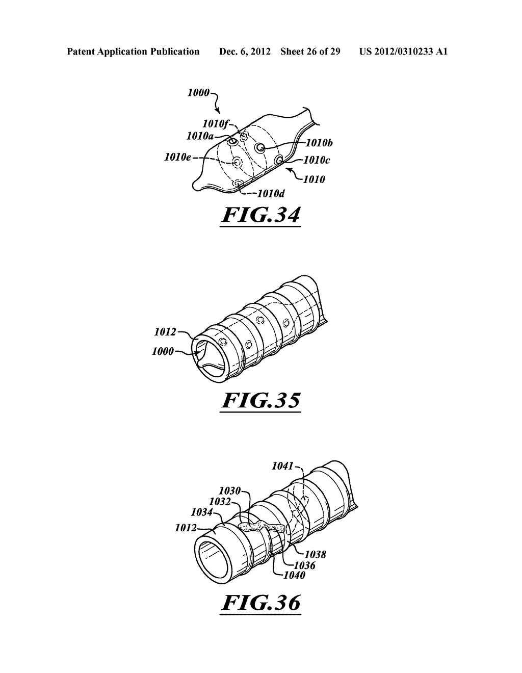 SYSTEMS, APPARATUSES, AND METHODS FOR TREATING TISSUE AND CONTROLLING     STENOSIS - diagram, schematic, and image 27