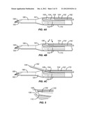 NEEDLE AND TINE DEPLOYMENT MECHANISM diagram and image