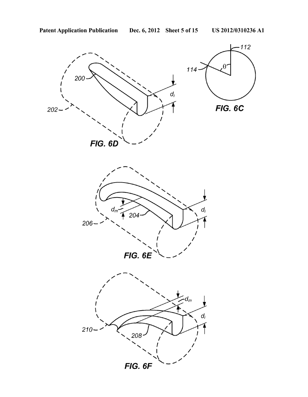 NEEDLE AND TINE DEPLOYMENT MECHANISM - diagram, schematic, and image 06