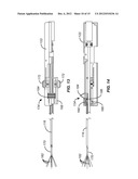 NEEDLE AND TINE DEPLOYMENT MECHANISM diagram and image