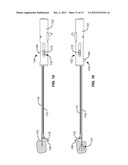 NEEDLE AND TINE DEPLOYMENT MECHANISM diagram and image