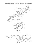 NEEDLE AND TINE DEPLOYMENT MECHANISM diagram and image